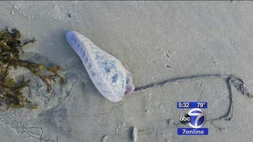 3 stung on Fire Island by Portuguese man-of-wars